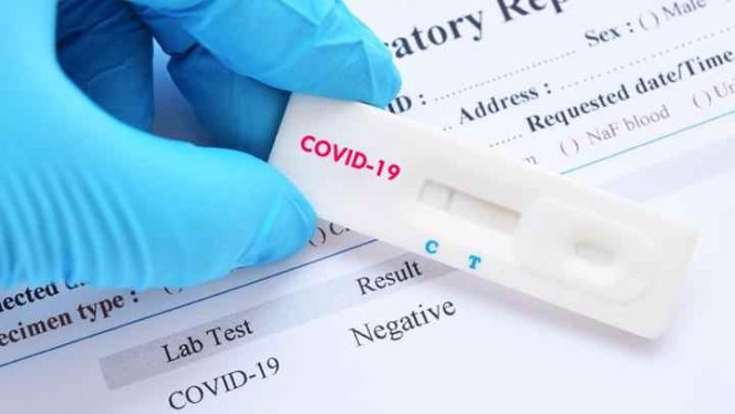 
 Mahasiswa Bolsel dan Pelaku Usaha Gratis Rapid Test